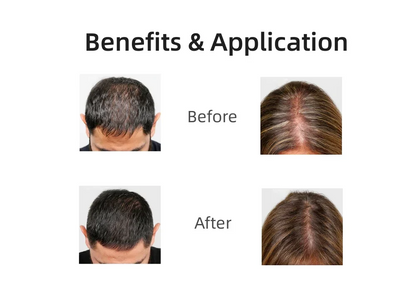 Red Light Therapy Cap